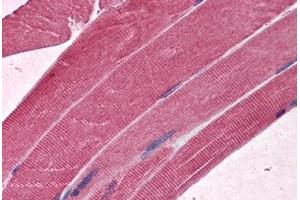 Human Skeletal muscle: Formalin-Fixed, Paraffin-Embedded (FFPE) (MBNL1 抗体  (AA 1-383))