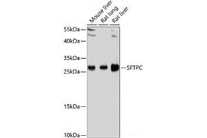 Western blot analysis of extracts of various cell lines using SFTPC Polyclonal Antibody at dilution of 1:1000. (Surfactant Protein C 抗体)