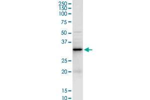Western Blotting (WB) image for anti-Galectin 3 (LGALS3) (AA 1-250) antibody (ABIN517488)