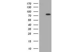 HEK293T cells were transfected with the pCMV6-ENTRY control (Left lane) or pCMV6-ENTRY C17orf28 (Right lane) cDNA for 48 hrs and lysed. (HID1/DMC1 抗体)