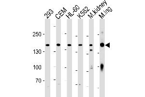 PKP4 Antibody (C-term) (ABIN1881657 and ABIN2843435) western blot analysis in 293,CEM,HL-60,K562 cell line and mouse kidney,lung tissue lysates (35 μg/lane). (Plakophilin 4 抗体  (C-Term))