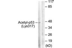 Western blot analysis of extracts from HeLa cells, treated with TSA 400nM 24h, using p53 (Acetyl-Lys317) Antibody. (p53 抗体  (acLys317))