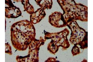 IHC image of ABIN7146688 diluted at 1:300 and staining in paraffin-embedded human placenta tissue performed on a Leica BondTM system. (CHST3 抗体  (AA 316-427))