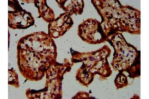 IHC image of ABIN7146688 diluted at 1:300 and staining in paraffin-embedded human placenta tissue performed on a Leica BondTM system. (CHST3 抗体  (AA 316-427))