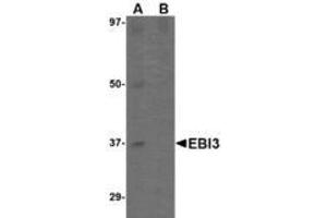 Image no. 2 for anti-Interleukin-27 subunit beta (IL-27b) (C-Term) antibody (ABIN341717) (EBI3 抗体  (C-Term))