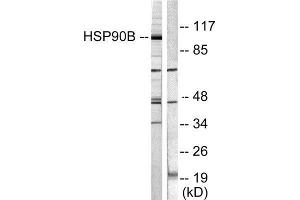Western Blotting (WB) image for anti-Heat Shock Protein 90kDa alpha (Cytosolic), Class B Member 1 (HSP90AB1) (Ser254) antibody (ABIN1847890) (HSP90AB1 抗体  (Ser254))