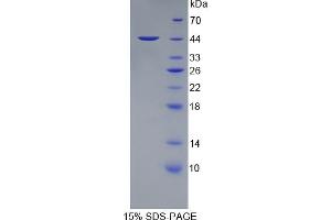 SDS-PAGE analysis of Human PTPRC Protein. (CD45 蛋白)