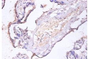 Immunohistochemistry of paraffin-embedded human placenta tissue using ABIN7147519 at dilution of 1:100 (CHMP2A 抗体  (AA 1-222))