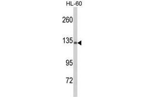 Western blot analysis of C5 Antibody (C5 抗体  (N-Term))