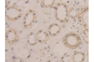 DAB staining on IHC-P; Samples: Human Kidney Tissue (BLMH 抗体  (AA 213-447))