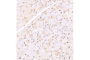 Immunohistochemistry (Paraffin-embedded Sections) (IHC (p)) image for anti-General Transcription Factor IIIC, Polypeptide 2, beta 110kDa (GTF3C2) antibody (ABIN7074038)