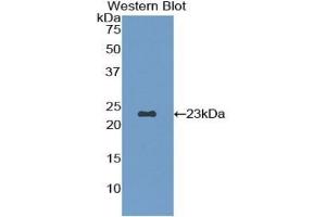 Detection of Recombinant FBN1, Rat using Polyclonal Antibody to Fibrillin 1 (FBN1) (Fibrillin 1 抗体  (AA 168-364))