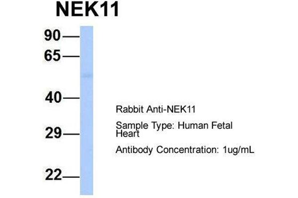 NEK11 抗体  (Middle Region)