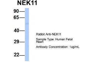Host:  Rabbit  Target Name:  NEK11  Sample Type:  Human Fetal Heart  Antibody Dilution:  1. (NEK11 抗体  (Middle Region))