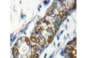 IHC-P analysis of Stomach tissue, with DAB staining. (SLAMF1 抗体  (AA 19-236))
