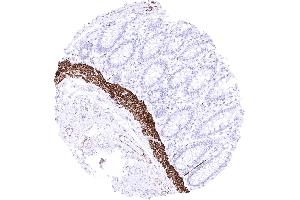 Rectum Strong desmin staining of lamina muscularis mucosae (Recombinant Desmin 抗体)