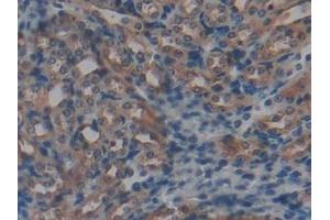 Detection of GSTt1 in Mouse Kidney Tissue using Polyclonal Antibody to Glutathione S Transferase Theta 1 (GSTt1) (GSTT1 抗体  (AA 7-240))