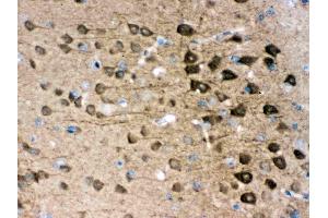 Anti- PGP9. (UCHL1 抗体  (C-Term))