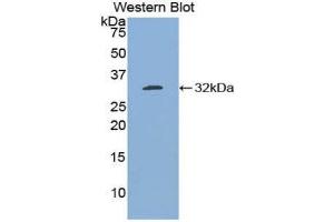 Western Blotting (WB) image for anti-B-Cell CLL/lymphoma 3 (BCL3) (AA 82-341) antibody (ABIN1858126) (BCL3 抗体  (AA 82-341))