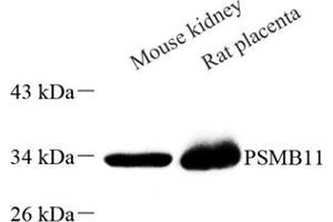 anti-Proteasome (Prosome, Macropain) Subunit, beta Type, 11 (PSMB11) antibody