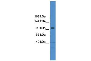 WB Suggested Anti-TRAK1 Antibody Titration: 0. (TRAK1 抗体  (Middle Region))