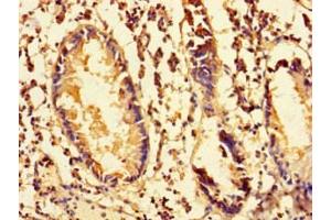 Immunohistochemistry of paraffin-embedded human appendix tissue using ABIN7142262 at dilution of 1:100 (MRPS28 抗体  (AA 72-187))