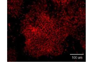 Immunofluorescence analysis of paraformaldehyde-fixed human embryonic stem cell, using OCT3/4 antibody at 1:100 dilution. (OCT4 抗体)