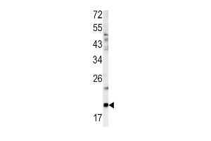 Western blot analysis of GCG antibody (N-term) (ABIN390411 and ABIN2840800) in mouse bladder tissue lysates (35 μg/lane). (Glucagon 抗体  (N-Term))