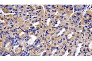 Immunohistochemistry (IHC) image for anti-DEAD (Asp-Glu-Ala-Asp) Box Polypeptide 58 (DDX58) (AA 1-211) antibody (ABIN7440305)