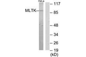 Western blot analysis of extracts from HeLa cells, using MLTK Antibody. (ZAK 抗体  (AA 701-750))