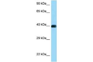 WB Suggested Anti-CD72 Antibody Titration: 1. (CD72 抗体  (C-Term))