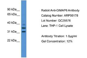 WB Suggested Anti-GIMAP6  Antibody Titration: 0. (GIMAP6 抗体  (C-Term))