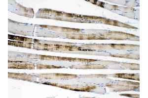 IHC analysis of ACTN3/Alpha Actinin 3 using anti- ACTN3/Alpha Actinin 3 antibody . (ACTN3 抗体  (C-Term))