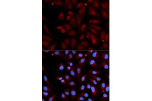 Immunofluorescence analysis of U2OS cells using MAOB antibody (ABIN5970749). (Monoamine Oxidase B 抗体)