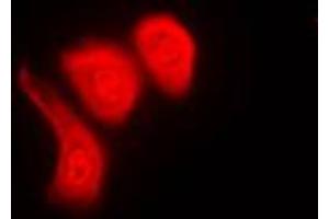 Immunofluorescent analysis of hnRNP K (pS284) staining in Raw264. (HNRNPK 抗体  (pSer284))