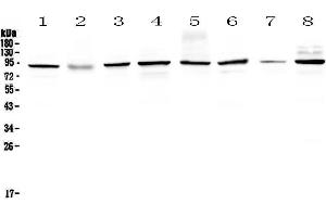 Western blot analysis of SAE2/UBA2 using anti-SAE2/UBA2 antibody .