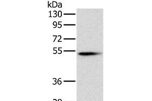 Western Blot analysis of Mouse pancreas tissue using PNLIP Polyclonal Antibody at dilution of 1:400 (PNLIP 抗体)