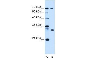 WB Suggested Anti-ATP6AP1L Antibody Titration:  0. (ATP6AP1L 抗体  (C-Term))