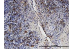 Immunoperoxidase of monoclonal antibody to PLIN3 on formalin-fixed paraffin-embedded human tonsil. (PLIN3 抗体  (AA 1-434))