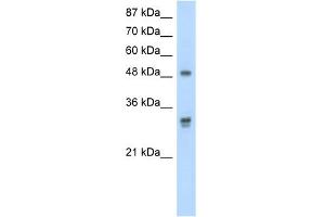 WB Suggested Anti-DDX19B Antibody Titration:  2. (DDX19B 抗体  (C-Term))