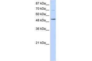 Western Blotting (WB) image for anti-IKAROS Family Zinc Finger 3 (Aiolos) (IKZF3) antibody (ABIN2461838) (IKZF3 抗体)