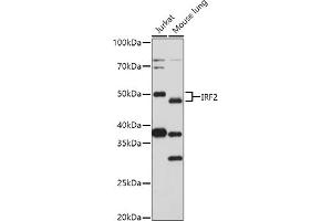 Western blot analysis of extracts of various cell lines, using (ABIN3023366, ABIN3023367, ABIN3023368 and ABIN6219659) at 1:1000 dilution. (IRF2 抗体  (AA 120-349))
