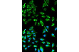 Immunofluorescence analysis of HeLa cell using TRAF6 antibody. (TRAF6 抗体)