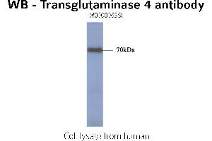 Image no. 1 for anti-Transglutaminase 4 (Prostate) (TGM4) antibody (ABIN347024) (TGM4 抗体)