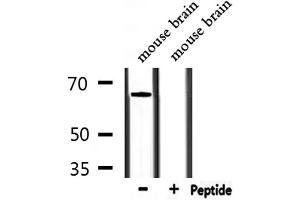 Western blot analysis of extracts from mouse brain, using STXBP1 Antibody. (STXBP1 抗体  (C-Term))