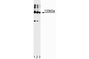 Western blot analysis of mGluR1alpha. (mGluR1 alpha 抗体)