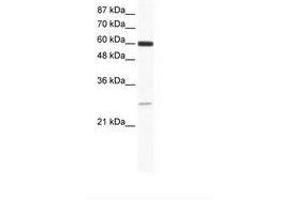 Image no. 1 for anti-ZFP91 Zinc Finger Protein (ZFP91) (AA 96-145) antibody (ABIN6736013) (ZFP91 抗体  (AA 96-145))