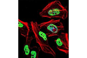Fluorescent confocal image of Hela cell stained with TRIM28 Antibody (N-term) R. (KAP1 抗体  (N-Term))