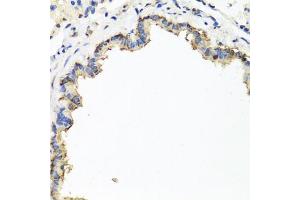 Immunohistochemistry of paraffin-embedded rat lung using CXCR4 antibody (ABIN6292854) at dilution of 1:100 (40x lens). (CXCR4 抗体)