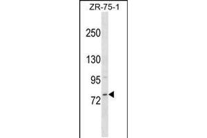 Western blot analysis in ZR-75-1 cell line lysates (35ug/lane). (MICALCL 抗体  (N-Term))